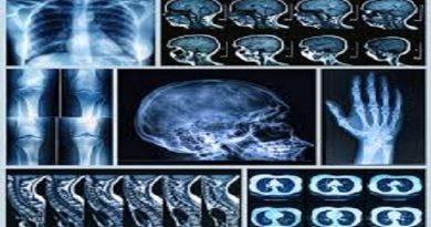 New Machine Algorithm Can Detect Heart and Fracture Risks Through Routine Bone Scans