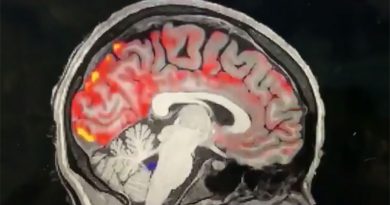 சீக்கிரமாக உறங்குவதன் அவசியம்! – ஆதாரத்தை படம்பிடித்து பாஸ்டன் பல்கலைக்கழக விஞ்ஞானிகள் சாதனை