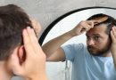 Hair Loss in Young Indian Men: Understanding the Causes